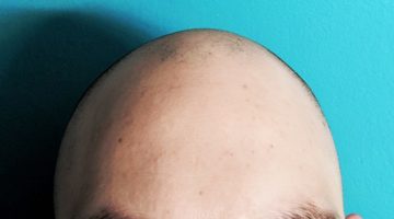 Should I Shave my Head Bald? The Dappered Guide to Losing your Hair.